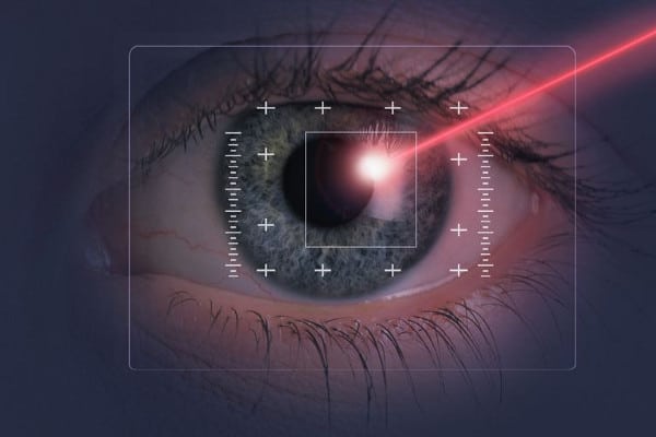 Lasik Surgery